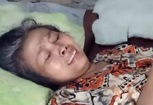 Warga Miskin Menderita Sakit Tumor Butuh Uluran Tangan