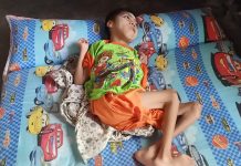 Warga Kurang Mampu Penderita Folio Berharap Bantuan