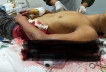 Diduga Salah Paham Dua Warga Desa Tanjung Kemala Bertikai